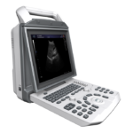 Portable ultrasound