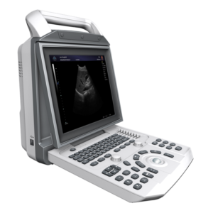 Portable ultrasound