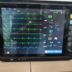 Patient monitor