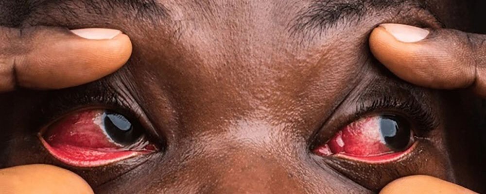 Red Eyes mtu akionesha