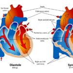 moyo huathirika na shinikizo la damu la juu, mishipa ya damu